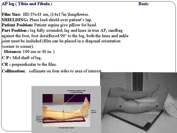 AP leg ( Tibia and Fibula ) Film Size: HD 35 x 43 cm,