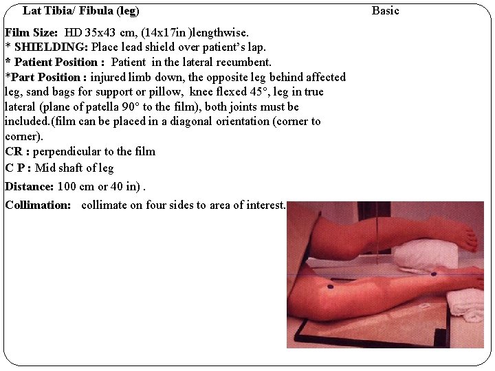 Lat Tibia/ Fibula (leg) Film Size: HD 35 x 43 cm, (14 x 17