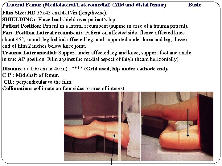 Lateral Femur (Mediolateral/Lateromedial) (Mid and distal femur) Basic Film Size: HD 35 x 43