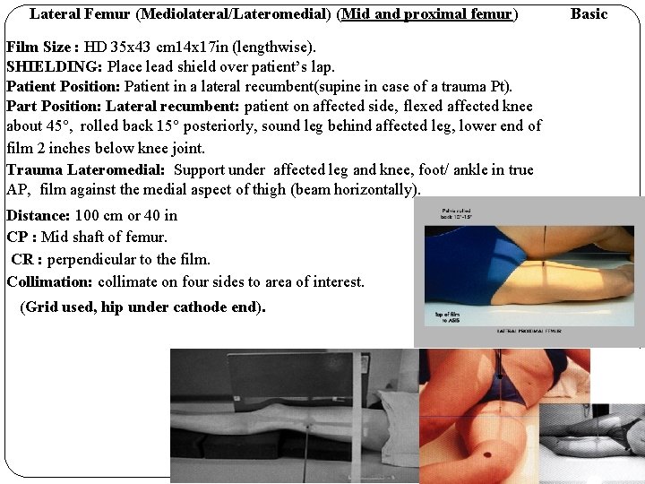 Lateral Femur (Mediolateral/Lateromedial) (Mid and proximal femur) Film Size : HD 35 x 43