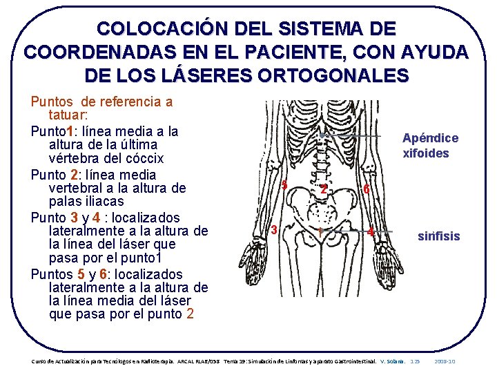 COLOCACIÓN DEL SISTEMA DE COORDENADAS EN EL PACIENTE, CON AYUDA DE LOS LÁSERES ORTOGONALES