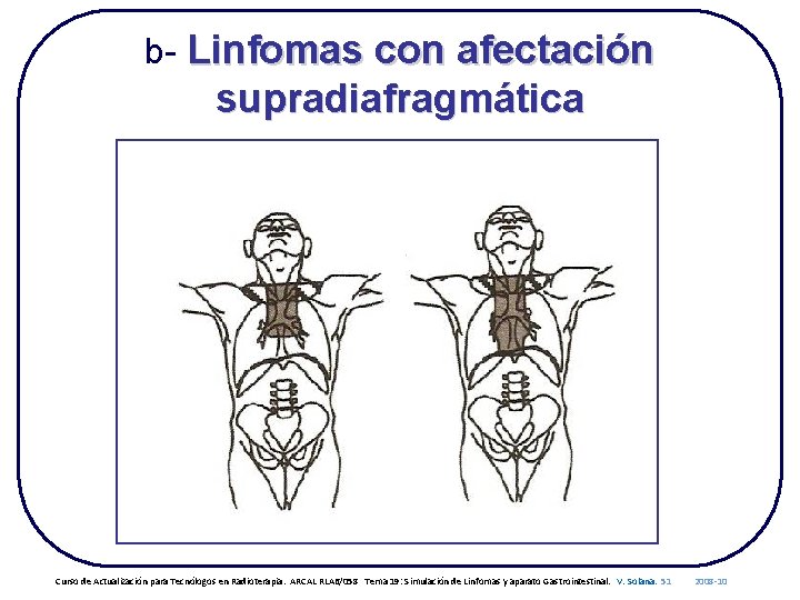 b- Linfomas con afectación supradiafragmática Curso de Actualización para Tecnólogos en Radioterapia. ARCAL RLA