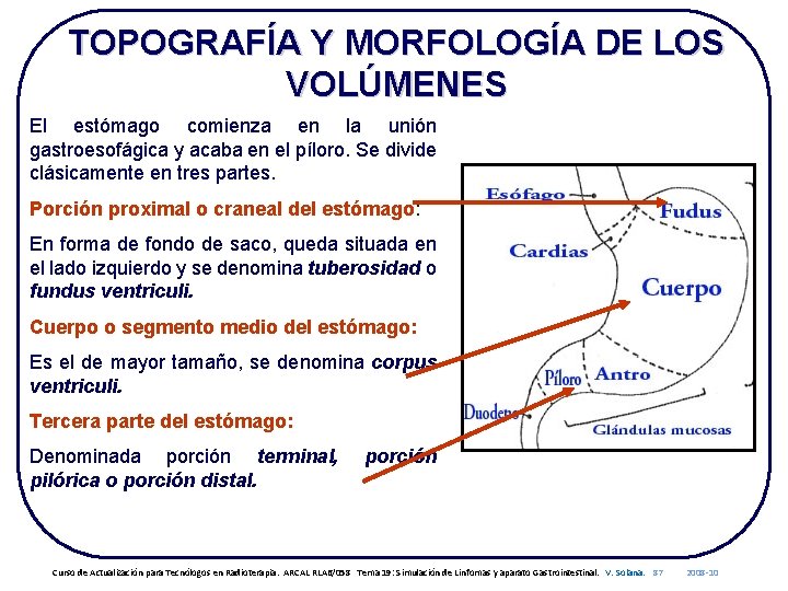TOPOGRAFÍA Y MORFOLOGÍA DE LOS VOLÚMENES El estómago comienza en la unión gastroesofágica y