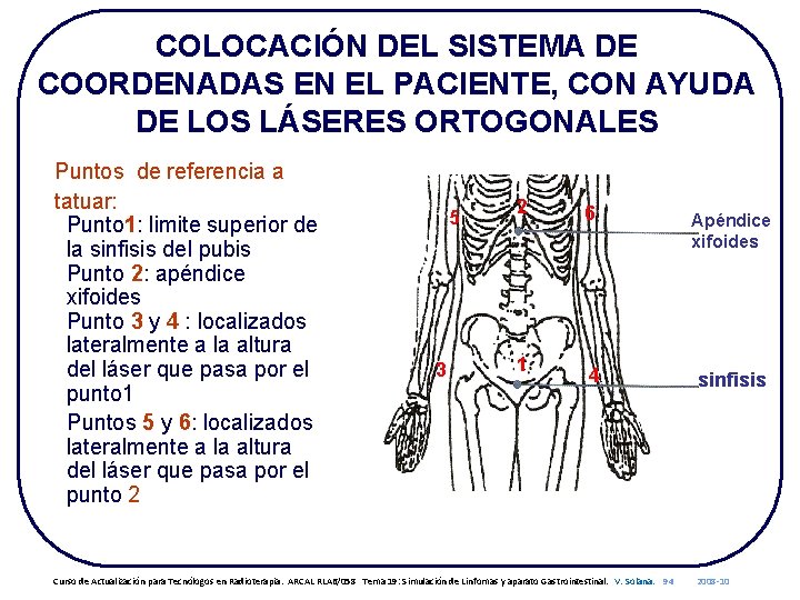 COLOCACIÓN DEL SISTEMA DE COORDENADAS EN EL PACIENTE, CON AYUDA DE LOS LÁSERES ORTOGONALES
