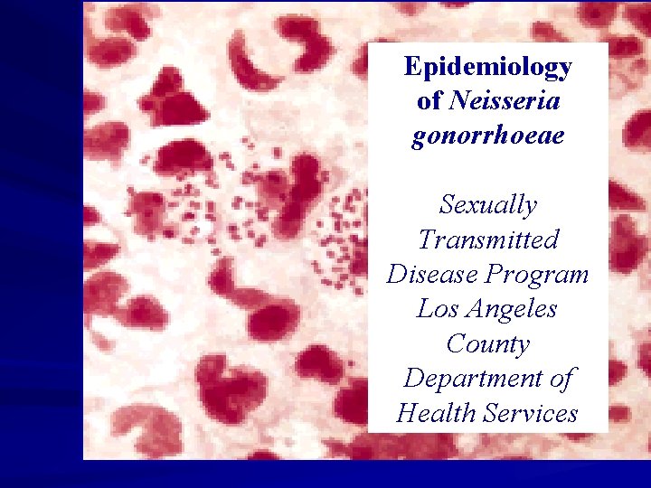 Epidemiology of Neisseria gonorrhoeae Sexually Transmitted Disease Program Los Angeles County Department of Health