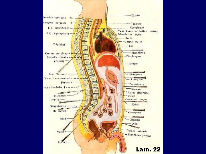 Lam. 22 