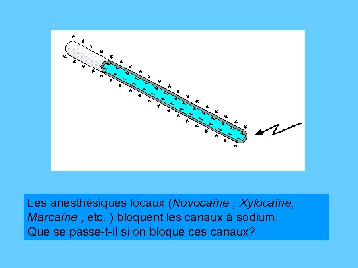 Les anesthésiques locaux (Novocaïne , Xylocaïne, Marcaïne , etc. ) bloquent les canaux à