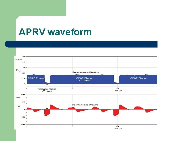 APRV waveform 