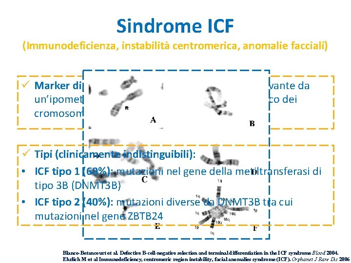 ritardo-mentale-quando-il-cariotipo-diagnostico-casi-clinici