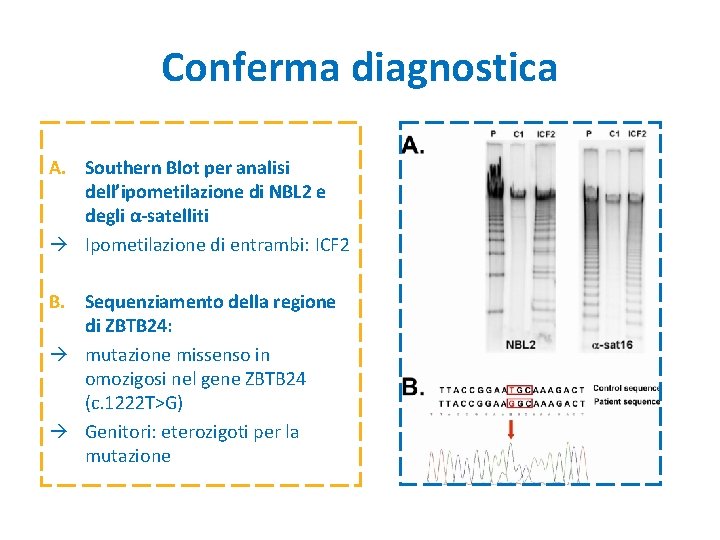 Conferma diagnostica A. Southern Blot per analisi dell’ipometilazione di NBL 2 e degli α-satelliti Conferma diagnostica A. Southern Blot per analisi dell’ipometilazione di NBL 2 e degli α-satelliti