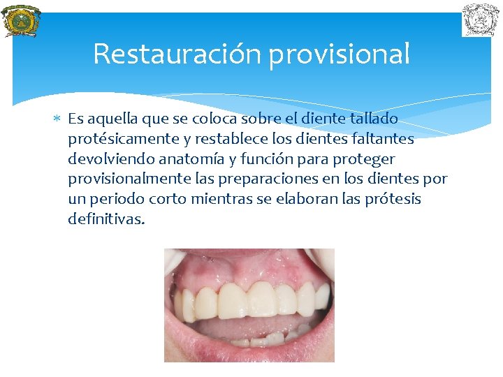 Restauración provisional Es aquella que se coloca sobre el diente tallado protésicamente y restablece