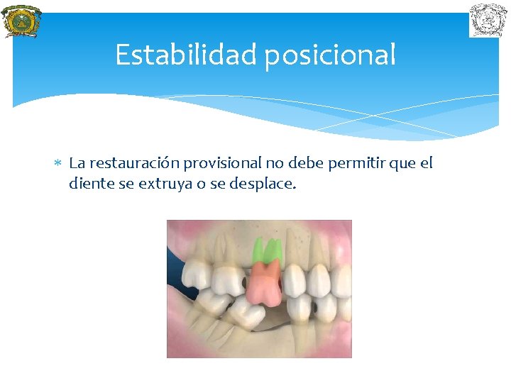 Estabilidad posicional La restauración provisional no debe permitir que el diente se extruya o