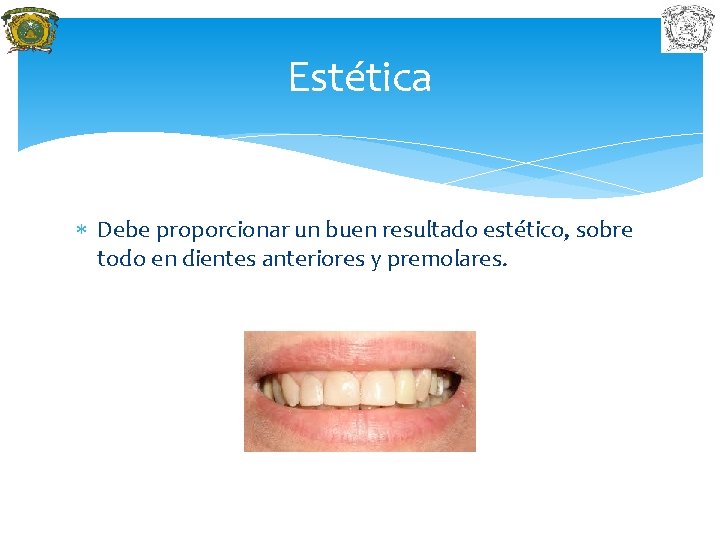 Estética Debe proporcionar un buen resultado estético, sobre todo en dientes anteriores y premolares.