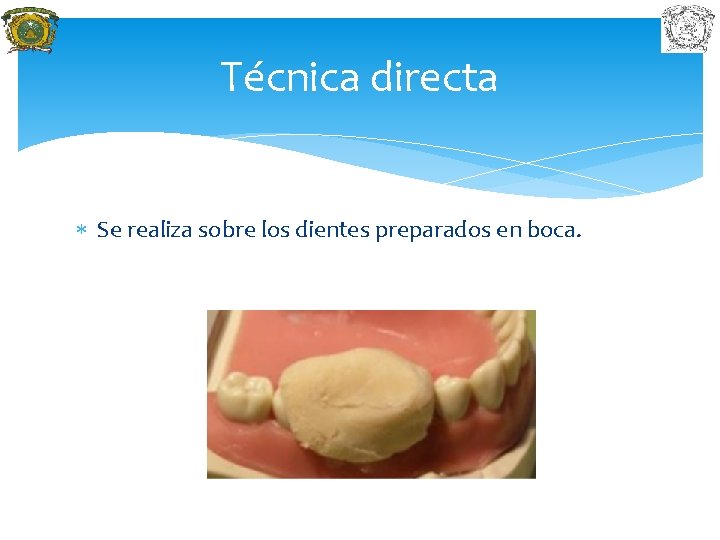 Técnica directa Se realiza sobre los dientes preparados en boca. 
