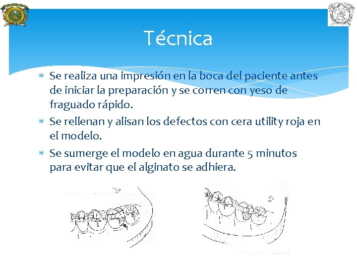Técnica Se realiza una impresión en la boca del paciente antes de iniciar la