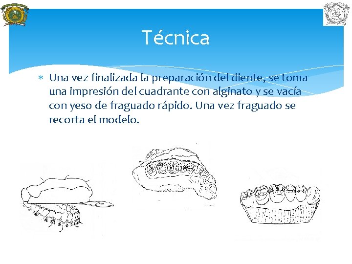 Técnica Una vez finalizada la preparación del diente, se toma una impresión del cuadrante