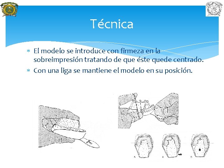 Técnica El modelo se introduce con firmeza en la sobreimpresión tratando de que éste