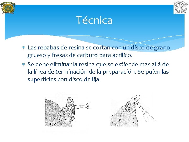Técnica Las rebabas de resina se cortan con un disco de grano grueso y