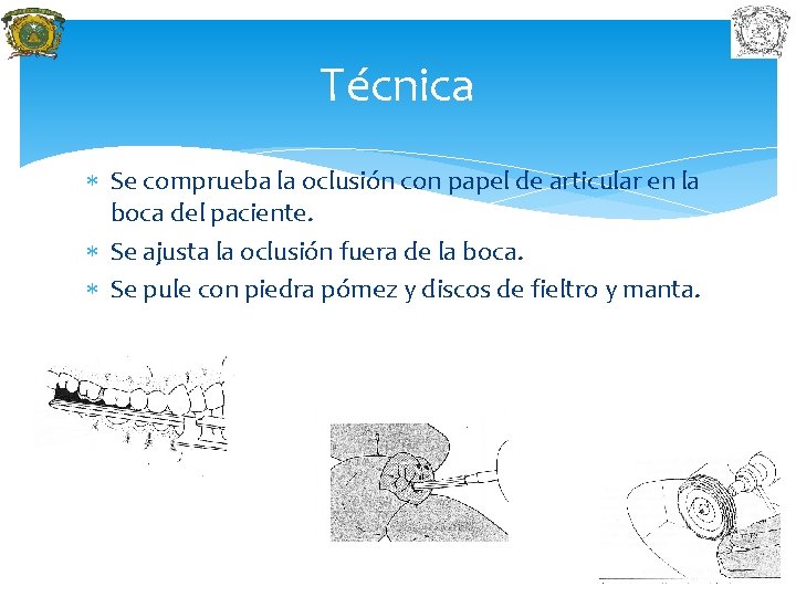 Técnica Se comprueba la oclusión con papel de articular en la boca del paciente.