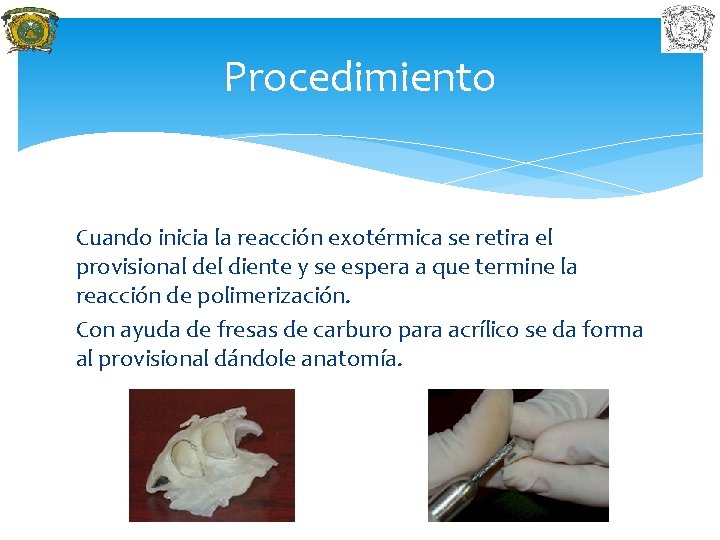 Procedimiento Cuando inicia la reacción exotérmica se retira el provisional del diente y se