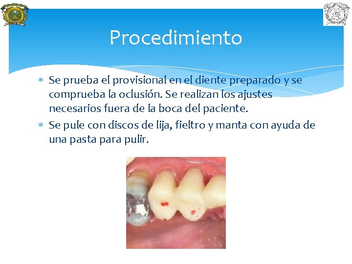 Procedimiento Se prueba el provisional en el diente preparado y se comprueba la oclusión.