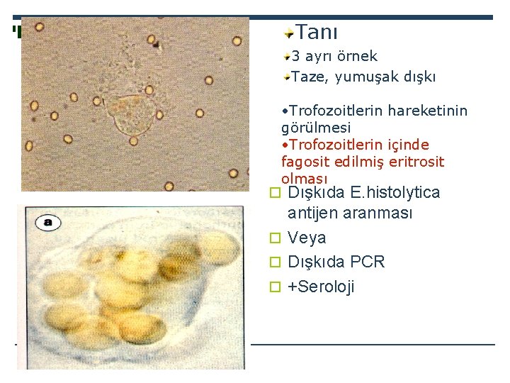 Tanı 3 ayrı örnek Taze, yumuşak dışkı • Trofozoitlerin hareketinin görülmesi • Trofozoitlerin içinde