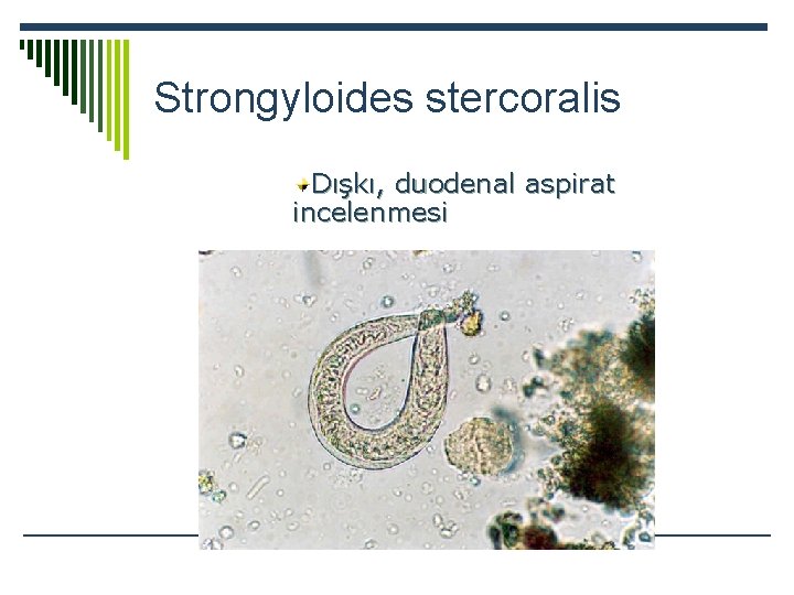Strongyloides stercoralis Dışkı, duodenal aspirat incelenmesi 