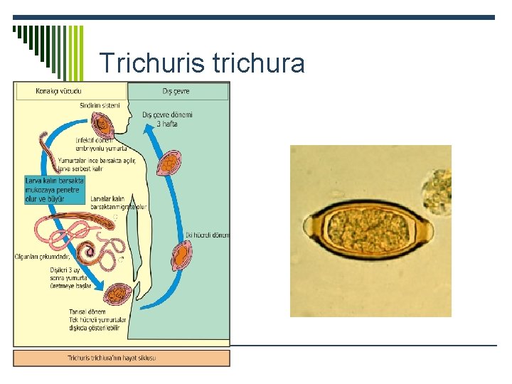 Trichuris trichura 