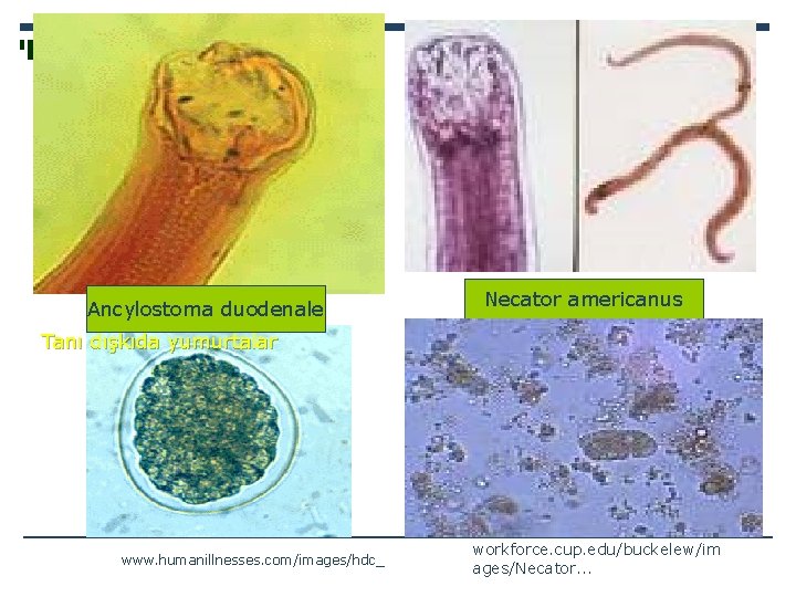 Ancylostoma duodenale Necator americanus Tanı dışkıda yumurtalar www. humanillnesses. com/images/hdc_ workforce. cup. edu/buckelew/im ages/Necator.