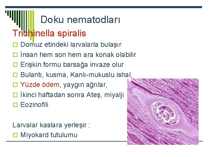 Doku nematodları Trichinella spiralis o Domuz etindeki larvalarla bulaşır o İnsan hem son hem