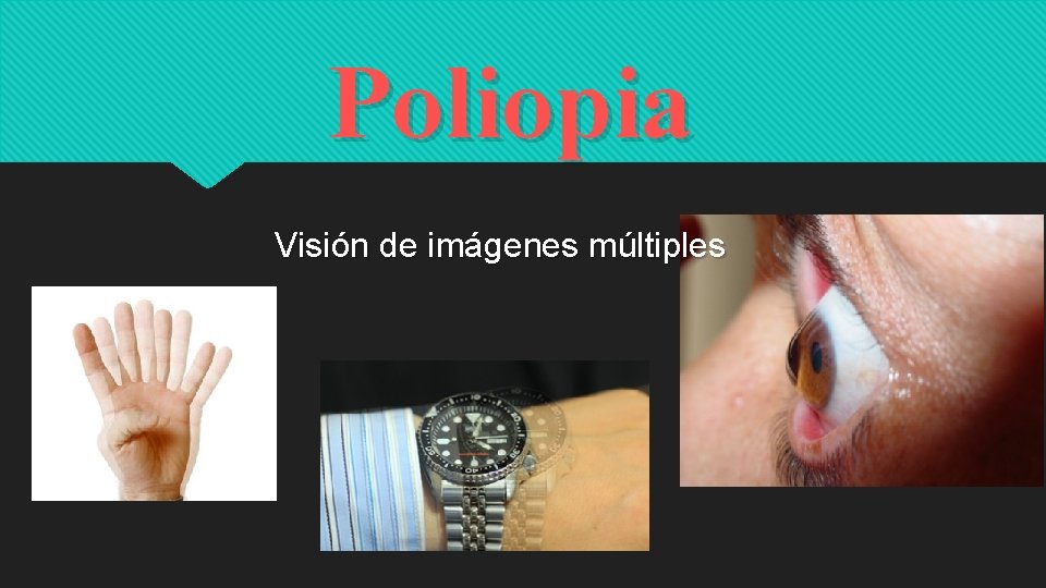 Poliopia Visión de imágenes múltiples 