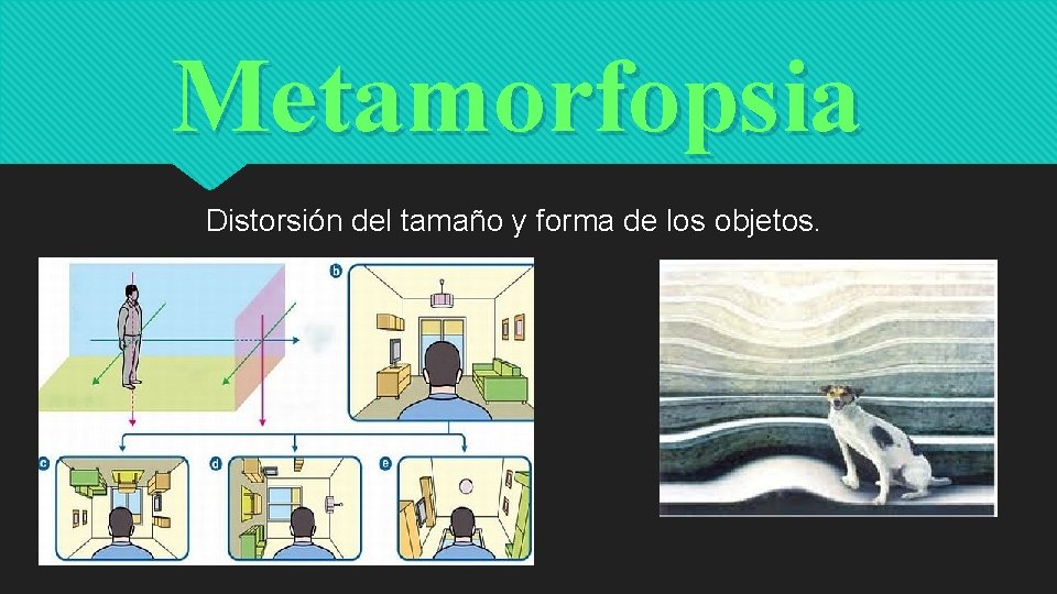 Metamorfopsia Distorsión del tamaño y forma de los objetos. 