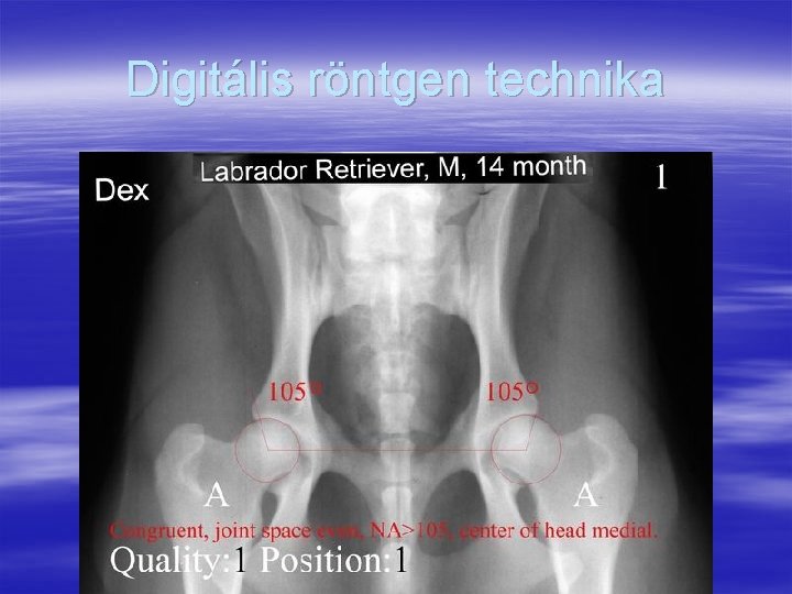 Digitális röntgen technika 