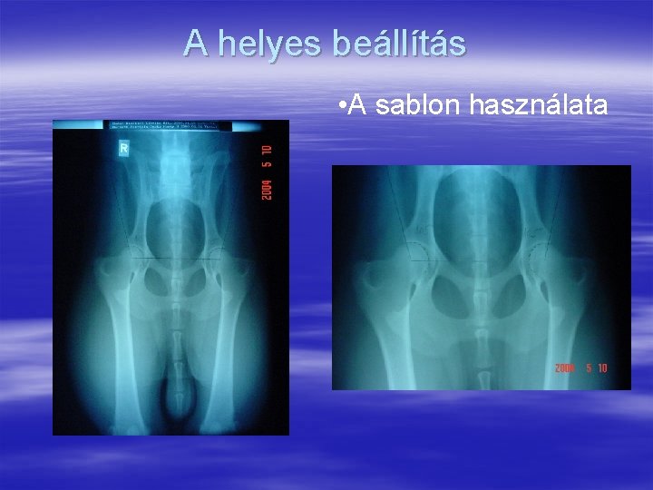 A helyes beállítás • A sablon használata 