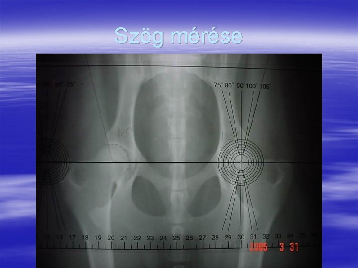 Szög mérése 