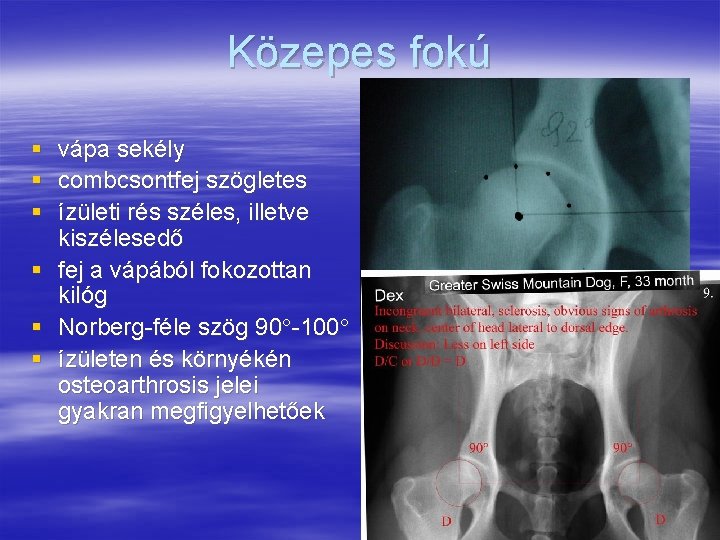 Közepes fokú § § § vápa sekély combcsontfej szögletes ízületi rés széles, illetve kiszélesedő