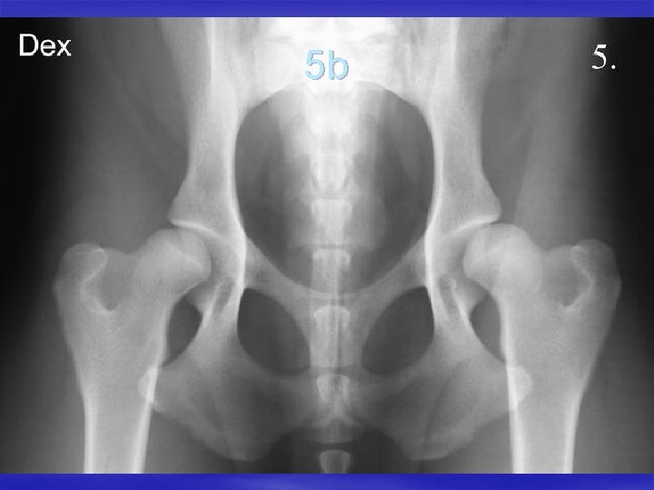5 b 