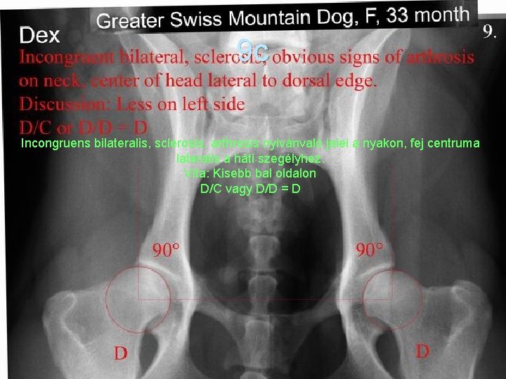 9 c Incongruens bilateralis, sclerosis, arthrosis nyivánvaló jelei a nyakon, fej centruma lateralis a