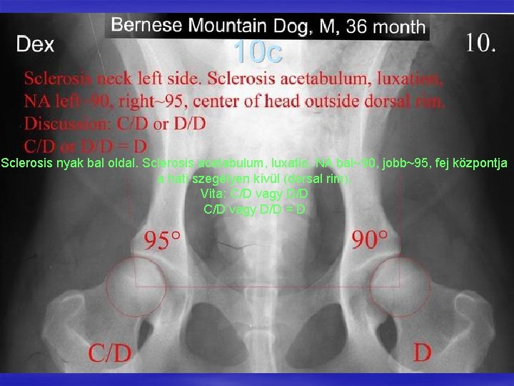 10 c Sclerosis nyak bal oldal. Sclerosis acetabulum, luxatio, NA bal~90, jobb~95, fej központja