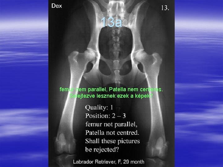 13 a femur nem parallel, Patella nem centeres. Selejtezve lesznek ezek a képek? 