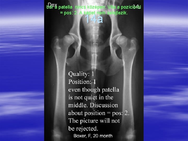 bár a patella nincs középen. Vita a pozícióról = pos: 2. A képet nem