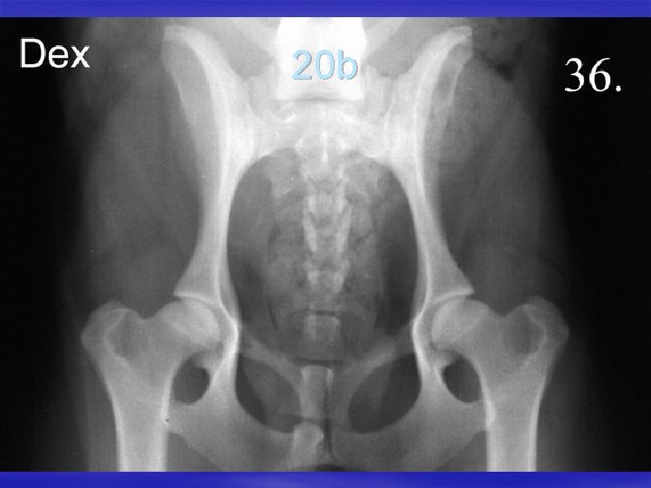 20 b 
