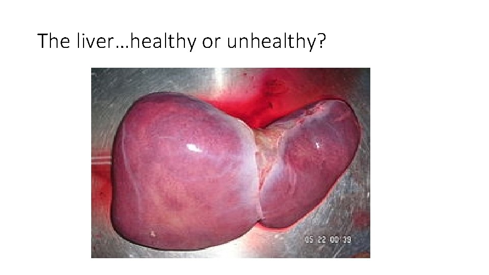 The liver…healthy or unhealthy? 