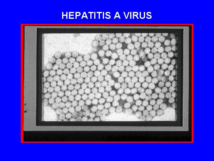 HEPATITIS A VIRUS 