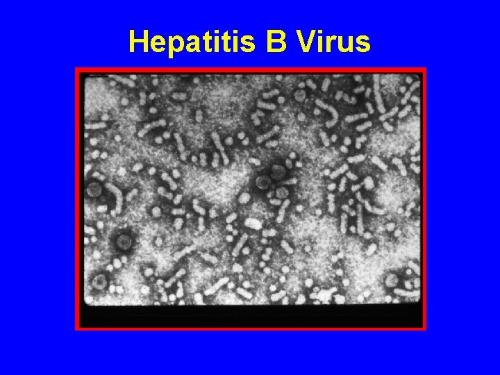 Hepatitis B Virus 