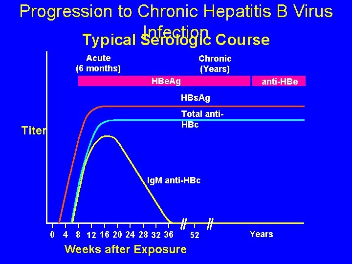 Progression to Chronic Hepatitis B Virus Infection Typical Serologic Course Acute (6 months) Chronic