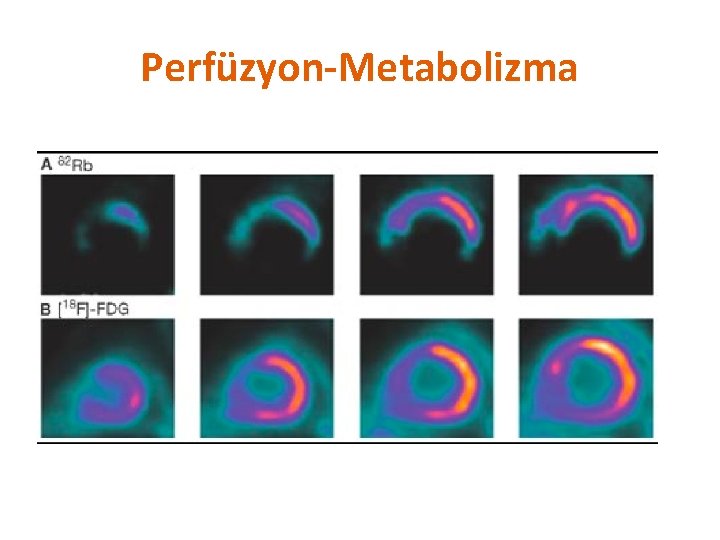 Perfüzyon-Metabolizma 