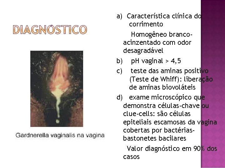a) Característica clínica do corrimento Homogêneo brancoacinzentado com odor desagradável b) p. H vaginal