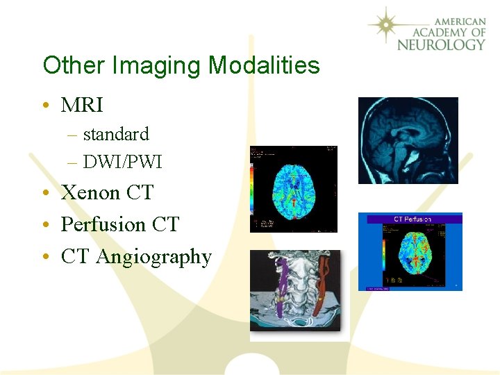 Other Imaging Modalities • MRI – standard – DWI/PWI • Xenon CT • Perfusion