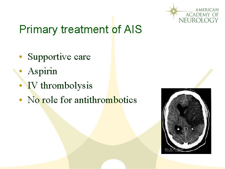 Primary treatment of AIS • • Supportive care Aspirin IV thrombolysis No role for